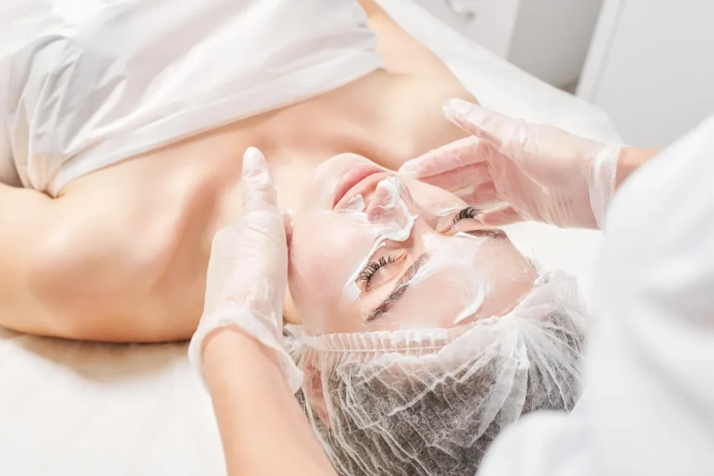 Peeling chemiczny twarzy - aplikacja preparatu z kwasami w Carella Ritual